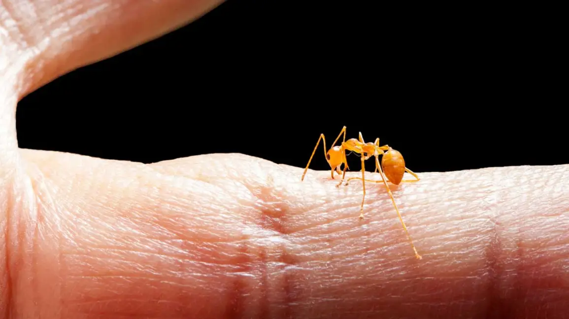 fire ant sting